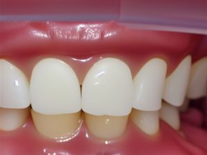 Rodzaje ruchomych protez dentystycznych
